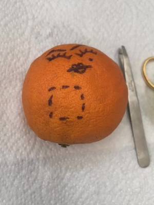 A post by @healthy_hospital on TikTok caption: Opal the Orange’s heart transplant was a huge success! #foryoupage #fyp