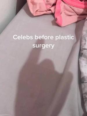 A post by @plasticsurgery_.x0 on TikTok