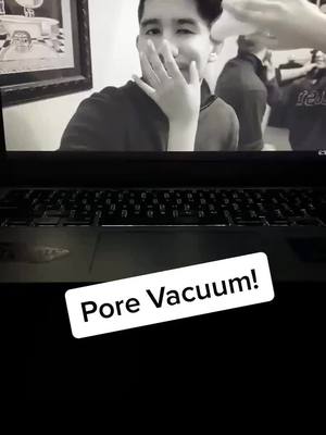 A post by @porevacuumplug on TikTok caption: You can get your own pore vacuum for a great price, link in bio! #pore #porevacuum #fyp #foryou #usa