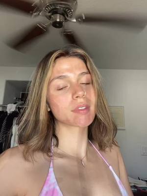 A post by @everskye777 on TikTok caption: In case you were wondering what was on my face in my last video it was a chemical peel and these are my results over five days! Enjoy #fyp ￼￼￼