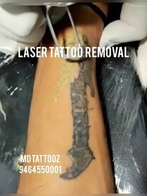 A post by @mdtattooz on TikTok caption: Laser tattoo removal with the safest method . Book your appointment now at 9464550001 , punjab