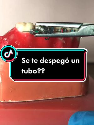 A post by @odontoescena on TikTok caption: Responder a @agos978 qué hacer si se te despega un tubo #AprendeEnTikTok #dentistaentiktok #odontoescena