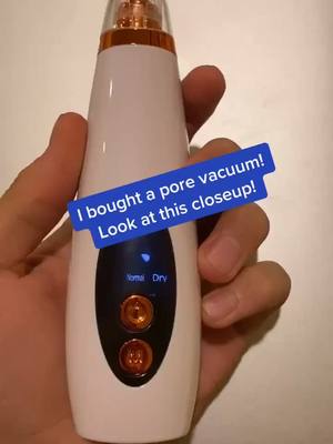 A post by @pore.vacuum.plug on TikTok caption: Pore vacuums available at link in bio! #porevacuum #pores #viral #fyp