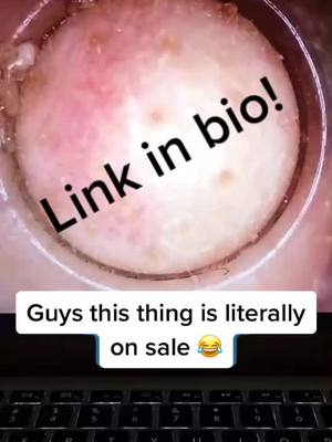 A post by @poresvacuum on TikTok caption: Link in bio for a CHEAP pore vacuum!