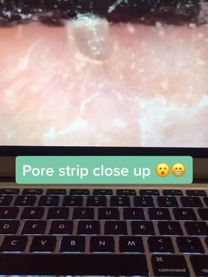 A post by @poresvacuum on TikTok caption: Pore strips available at link in bio! #porevacuum #pores #viral #fyp