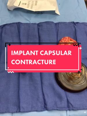 A post by @brownplasticsurgery on TikTok caption: Capsular Contracture #LearnOnTikTok #brownsanatomy #plasticsurgery