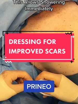 A post by @brownplasticsurgery on TikTok caption: Scar Dressings #LearnOnTikTok #plasticsurgery #brownsanatomy #scar