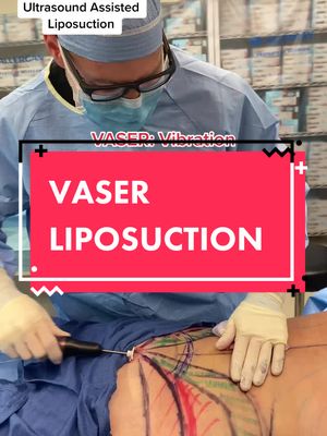 A post by @brownplasticsurgery on TikTok caption: VASER Liposculpting #LearnOnTikTok #brownsanatomy #plasticsurgery