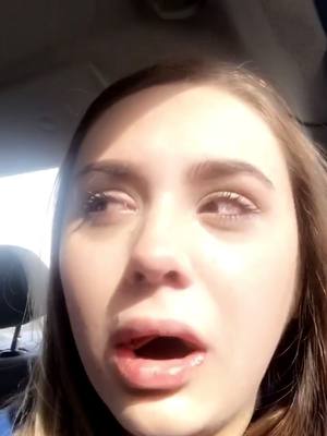 A post by @itsmadikingg on TikTok caption: #wisdomteeth i don’t even like kodak like that 😂