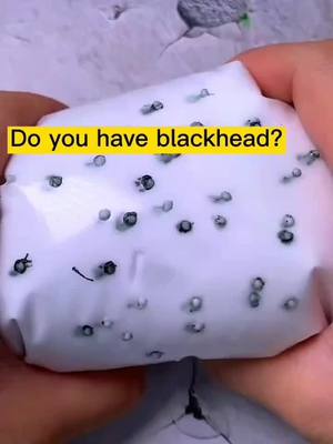 A post by @beauty_makeup6666 on TikTok caption: Effectively suck out your blackheads without harming your skin. Go to My homepage bio link to order #skin #zitpicking #pimples #acen #skincare