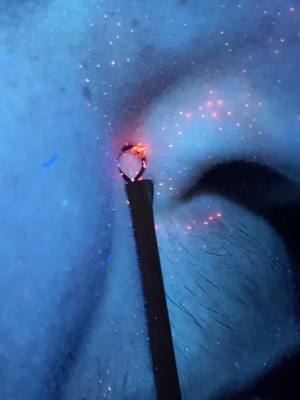 A post by @theestarcatcher on TikTok caption: This is StarCatching💫 #glow #GlowUp #acne #beauty #fyp #satisfying #starcatching #aesthetic #starcatcher✨ #breakingoutforclout♨️