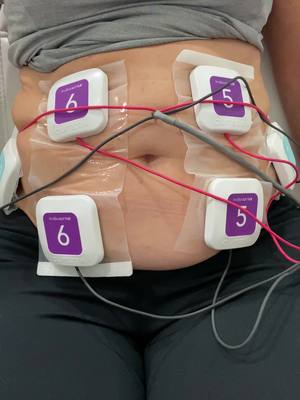 A post by @nalluriplasticsurgery on TikTok caption: Trusculpt flex: 45-min electrical stim treatment to build up muscle mass.  #fyp #foryou #foryoupage #muscle #fitness #abs #booty #getfit #modeling