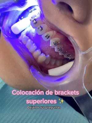 A post by @clinicasdentalsonrie on TikTok