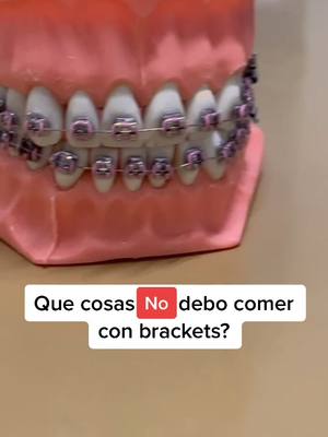 A post by @clinicasdentalsonrie on TikTok caption: #bracekts #ortodoncia #braces #orthodontics #comida #si #no #lentejas #fy #respuesta #dudas #dentista #