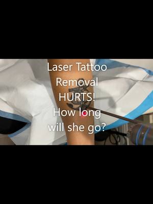 A post by @nalluriplasticsurgery on TikTok caption: What does laser tattoo removal feel like? #tattoo #tattooremoval #laser #skin #plasticsurgeon #lasertreatment #plasticsurgery #fyp #foryoupage