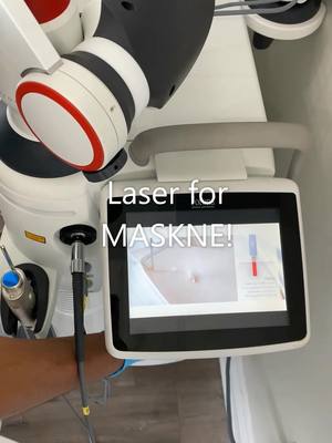 A post by @nalluriplasticsurgery on TikTok caption: Maskne part 4: Laser maskne treatment #maskne #laser #skin #lasertreatment #plasticsurgery #fyp #foryoupage #mascne