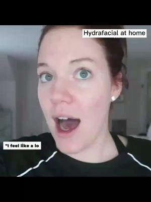 A post by @facecares on TikTok caption: Hydrafacial at home. #skincare #facialcare #beauty #hydrafacial #facialathome