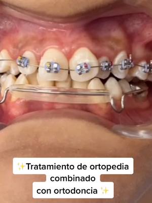 A post by @clinicasdentalsonrie on TikTok