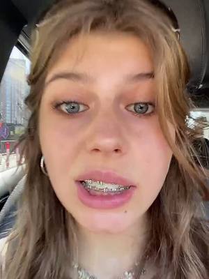 A post by @bella.loureiro on TikTok caption: very gassed #fyp #bracesoff #braces