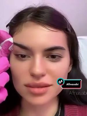 A post by @afinasabi_ on TikTok caption: #нитевойлифтинг#лисьиглазки