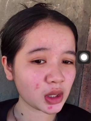 A post by @mookasa5 on TikTok caption: មូលហេតុដែលខ្ញុំបាត់មុខមួយរយៈ  តែអរគុណសម្រាប់ការមើលងាយ ដែលអោយខ្ញុំបានមុខស្អតមកវិញ🙏☺️😊🥰