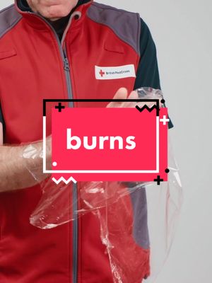 A post by @firstaidtoolkit on TikTok caption: New guidance! How to treat a burn. #firstaid #LearnOnTikTok