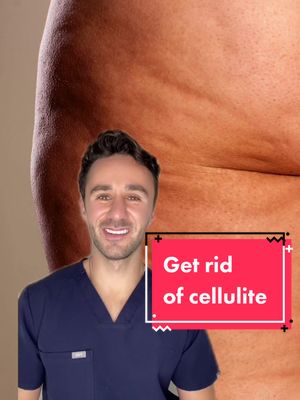 A post by @dr.ryan.md on TikTok caption: Get rid of cellulite. #greenscreen #cellulite #cellfina #cellulaze #dermtok