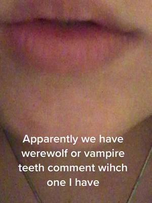 A post by @starshine_herd on TikTok caption: Don’t mind my crooked yellow teeth