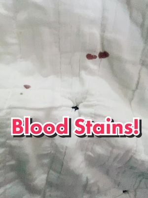 A post by @cleanthishome on TikTok caption: #bloodstains #toughstains #stainremover #CleanTok #folex #folexcarpetcleaner #cleanthishome #lissaathome #nowitsclean #cleantiktok #organizedhomeorganizedmind #vp #fyp @cleanthishome