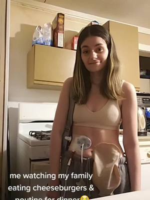 A post by @kaliroselea on TikTok caption: #stomabag #vascularcompressionsyndromes #chronicallyawesome #jtubefed #gastroparesis #gidysmotility #tubie #feedingtube #smas #stomachproblems #chronicillness #loopileostomy #gtube #jtube #superiormesentericarterysyndrome