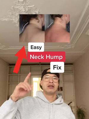 A post by @massageonpoint on TikTok caption: Easy Neck Hump Fix to try at Home. Share this with someone who needs it. Follow for Neck Pain relief. #neckhump#dowagershump#neckpain#LearnOnTikTok