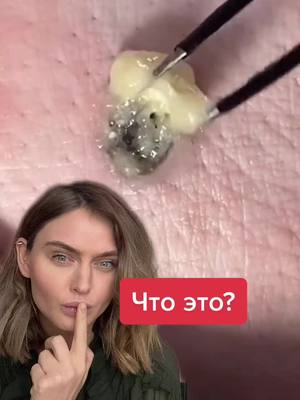 A post by @doc.polner on TikTok caption: #чтоэтотакое