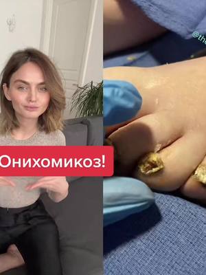 A post by @doc.polner on TikTok caption: #дуэт с @themedipedispa #косметолог #дерматолог