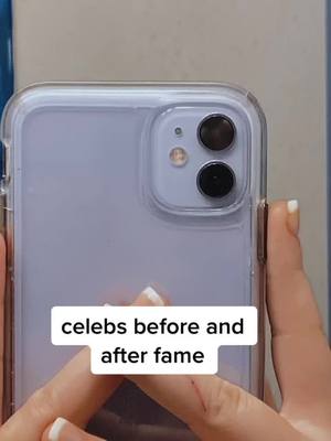 A post by @bliss.axsthetic on TikTok caption: celebs before and after fame🤩👍 #celebrity #celebsbeforeplasticsurgery #celebrities #kimkardashian #michaeljackson #foru #foryou #fyp #foryou #foryoupage