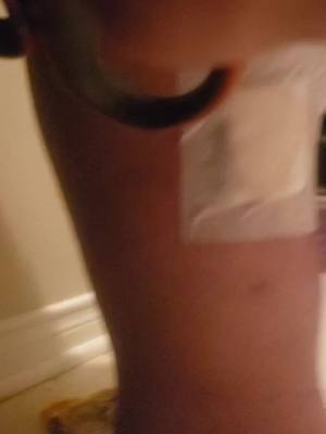 A post by @ray_ray1978 on TikTok caption: Changing my own bandage on my leg with the stuff they gave me in the hospital.