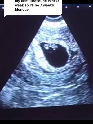 A post by @highfrequencyfilms1 on TikTok caption: Reply to @monbelinda  6 weeks Baby #ultrasound #ultrasoundtech #MomsofTikTok #babiesoftiktok #ivf