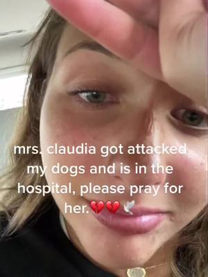 A post by @madison.hewitson on TikTok caption: go fund me is in my bio. i cant not believe such a beautiful women gets attacked like this. please have her in your prayers, her injury’s are extremely major.🕊💔🕊 @I AM THE GREATEST