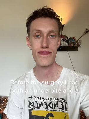 A post by @oskaroblixtrar on TikTok caption: 3 weeks since my surgery!#jawsurgerycheck #jawsurgeryrecovery #jawsurgery