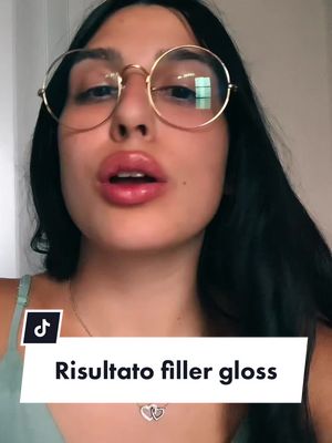 A post by @rosegoldcosmetics.it on TikTok caption: 😍 #fillerlabbra