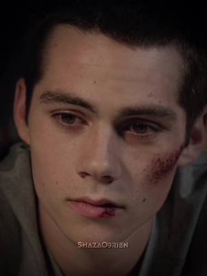 A post by @shaza0brien on TikTok caption: Back from the dead #shaza0brien  #stilesstillinski #stilesstilinskiedit #stilesedit #stiles #dylanobrien #dylanobrienedit #teenwolf #teenwolfedit 