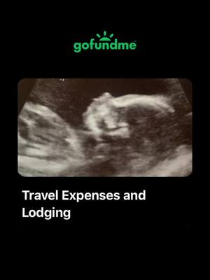 A post by @allyssa_m_labombard on TikTok caption: #GoFundMe #baby #omphaloceleawareness #omphalocele #travelexpense #pleasesupport #pleaseshare #pleasedonate