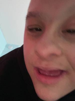 A post by @liamandsydneystiktok24 on TikTok caption: #fyp #foryoupage #foryoupageofficiall #downsyndrome