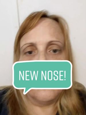 A post by @heidi.interrupted on TikTok caption: #fyp #foryoupage #nosejob #rhinoplasty #septoplasty #sinussurgery 