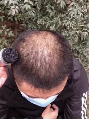 A post by @topnice00 on TikTok caption: Omg🤣my dad needs it very much #CapCut  #wighacks #goodstuff #hairpiece #tiktokmademebuyit #hairstyle #foryou #useful #hairhack #hairstuff #haircare 