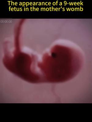 A post by @pedicurist88 on TikTok caption: How many weeks are you pregnant? #pregnant #fetus #appearance #womb #foryou #fypシ