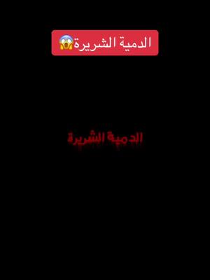 A post by @faressamier862 on TikTok caption: #أكسبلور_متابعه_لايك_كومنت🤍 #fyp #foryou #fypシ #fypシ #funny #fypage #foryourpage #fypシ゚viral #foryoupage 