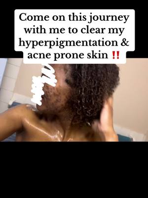 A post by @jadalove on TikTok caption: Day 1: Come on this journey with me to clear my hyperpigmentation & acne prone skin‼️. I have always suffer with acne for as long as i can remember, i followed all the dermatologist tips and suggestions. I even followed people with the clearest skin. I realized i had to take matters into my own hands & find out what works for me. I have a problem with being consistent so here i am putting this out on tiktok so you guys can hold me accountable. Lmk if you guys have any suggestions, & i’m also looking for a night time routine as well‼️ #hypergigmentation #acneskin #acneproneskin #roadtoclearskin❤️ #fypシ #blackgirltiktok #skincareroutine #skincaretips 