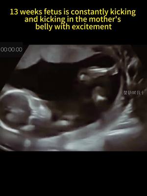 A post by @pedicurist88 on TikTok caption: How many weeks are you pregnant? #pregnant #fetus #kick #excitement #foryou #fypシ 