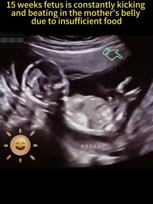 A post by @pedicurist88 on TikTok caption: How many weeks are you pregnant? #pregnant #fetus #hungry #kick #beating #foryou #fypシ 