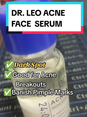 A post by @mhundztv on TikTok caption: DR. LEO ACNE FACE SERUM ✅ Fade Away Dark Spots ✅ Clear away pimples and Marks ✅ Banish away Acne and Marks #fyp #foryoupage #drleo #drleoacneessence #drleoacnedryinglotion #drleoacne